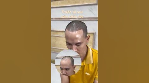 Xăm tóc hói chữ m #reviewxămtóc