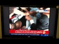 مذبحة ميدان التغيير صنعاء اليمن Yemen massacre Sanaa