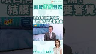 眼白有血但不痛？結膜下出血 患者需要警覺！#shorts #結膜下出血 #結膜