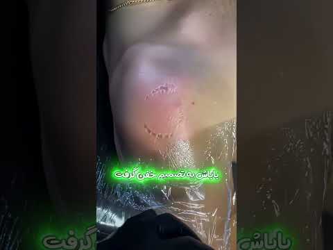گاز هاش جاودانه شد