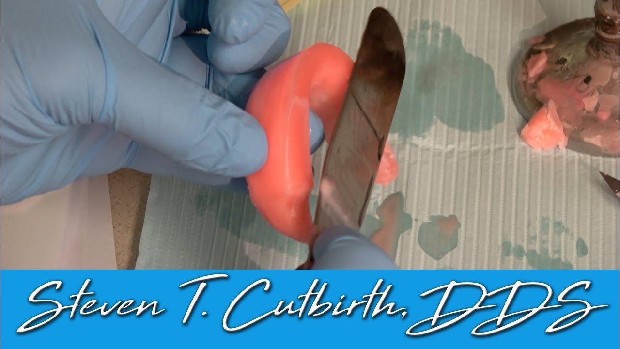 Fabrication of Implant Secured Denture - Dental Minute with Dr. Steven T. Cutbirth, DDS