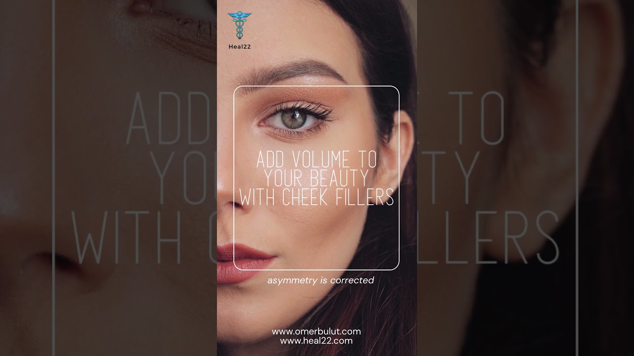 Get Cheek Fillers, Add Vibrancy to Your Face! | Heal22