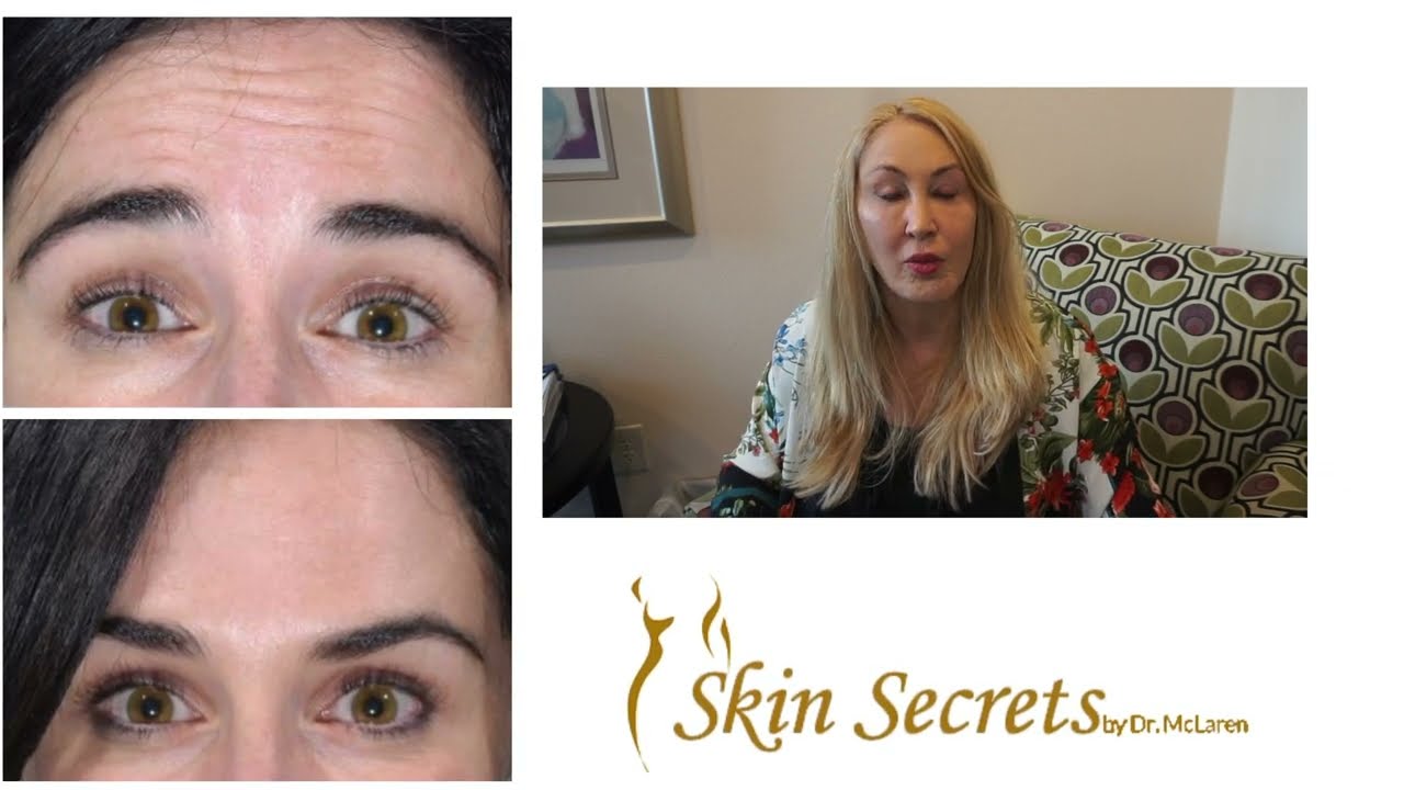 Brow Lift | Botox | Skin Secrets by Dr. McLaren in Cape Coral, FL and