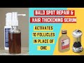 DIY Bald Spot Repair and Maximum Hair Thickening Serum | DHT Blocker Hair Growth Serum