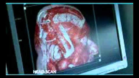 somatom definition flash