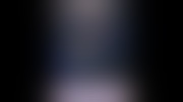 Posteromedial Approach to Proximal Tibia Fractures : Dr Jignesh Pandya