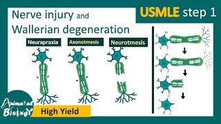 Nerve injury | Wallerian degeneration | Mechanism of  wallerian degeneration | USMLE