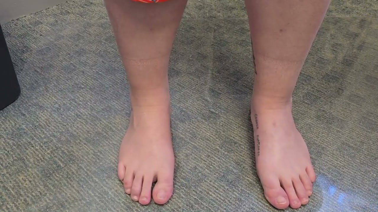 Процедура Hyprocure на правой стороне