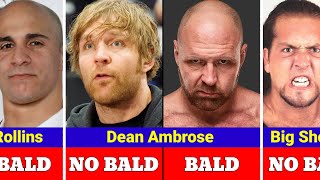 Wwe Bald Wrestler Transformations Before And After