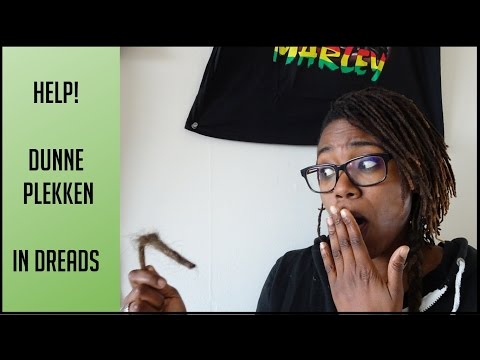 Dunne en Zwakke Plekken in Dreads Voorkomen? 5 Tips!