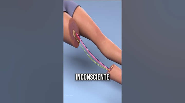 Como funciona uma cirurgia? #shorts