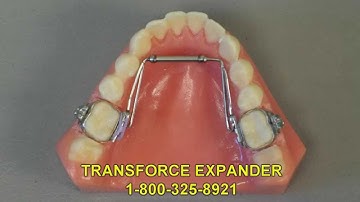 TransForce Expander Appliance | Arch Expander Appliance