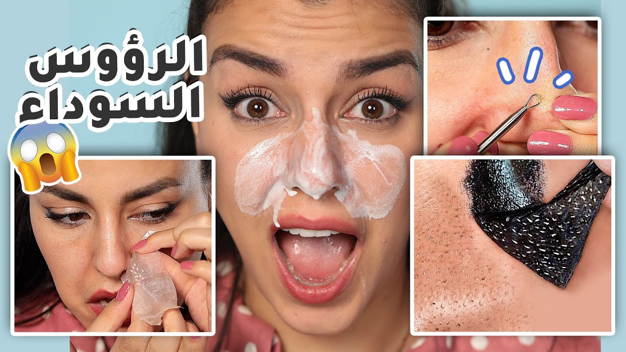 جربت أشهر 5 طرق لازالة الرؤوس السوداء 😱 شوفوا ايش سوى الجيلاتين بوجهي😭🥵