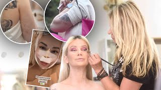 Premijerno Dušica Jakovljević Skinula Zavoje I Pokazala Novo Lice Radila Nos, Vrat I Ruke