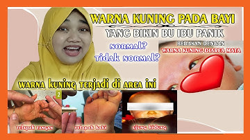 MPASI, Ibu Panik?? Warna Kuning pada Telapak Tangan dan Kaki Bayi
