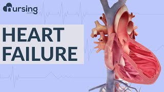 Causes, Symptoms, and Diagnostics of HEART FAILURE (Nursing School Lessons)
