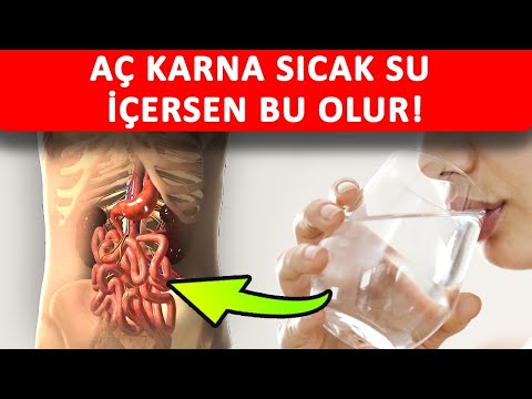 Her Gün Sıcak Su İçmek 10 Büyük Mucize Neden Oluyor!