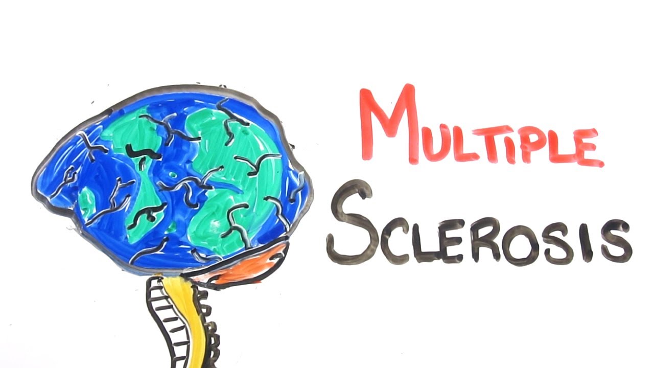 Multiple sclerosis