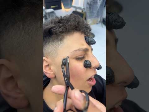 ازالة الحباية المتسلطنة من الخد       