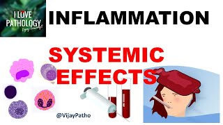 INFLAMMATION Part 10: Systemic effects of Inflammation