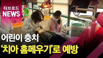 [건강상식]어린이 충치 예방법 ‘치아홈메우기’_티브로드서울