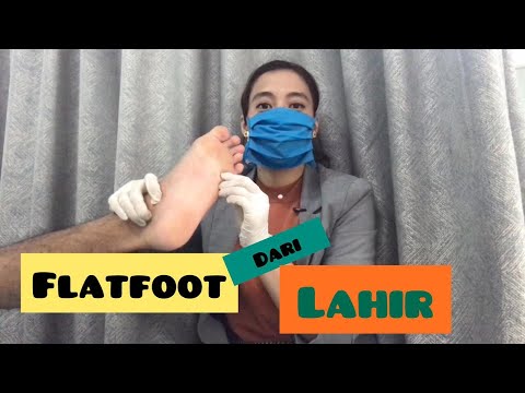 Video: Flat Feet: Pengobatan, Penyebab & Lainnya