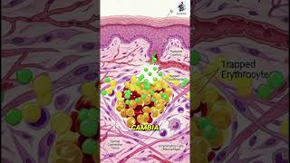 Perché si formano i lividi? #medicina #science #animation