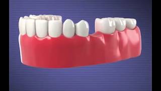 COMMON DENTAL PROCEDURES