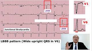 EKG Trainer (Case 9) Answer