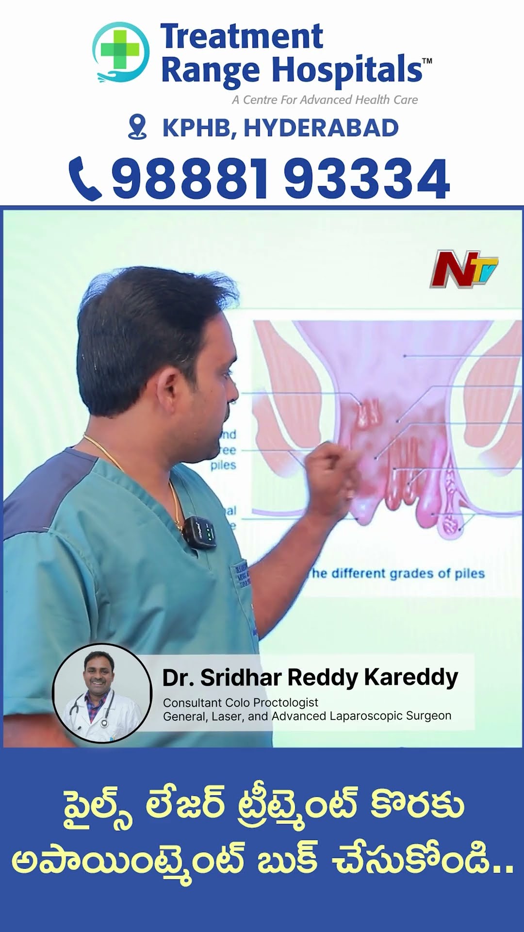 Piles Laser Surgery l Best Treatment for Piles l Treatment Range Hospitals  Hyderabad l NTV