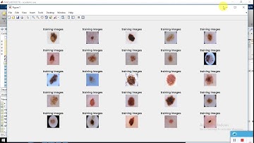 skin lesion segmentation using deep learning