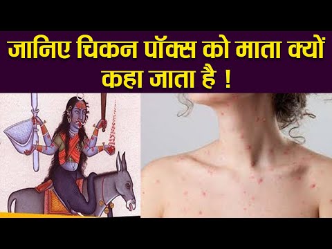 वीडियो: क्या चिकनपॉक्स हवा से फैलता है?