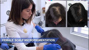 Scalp Micropigmentation for Women | Thickest Fullest Looking Hair
