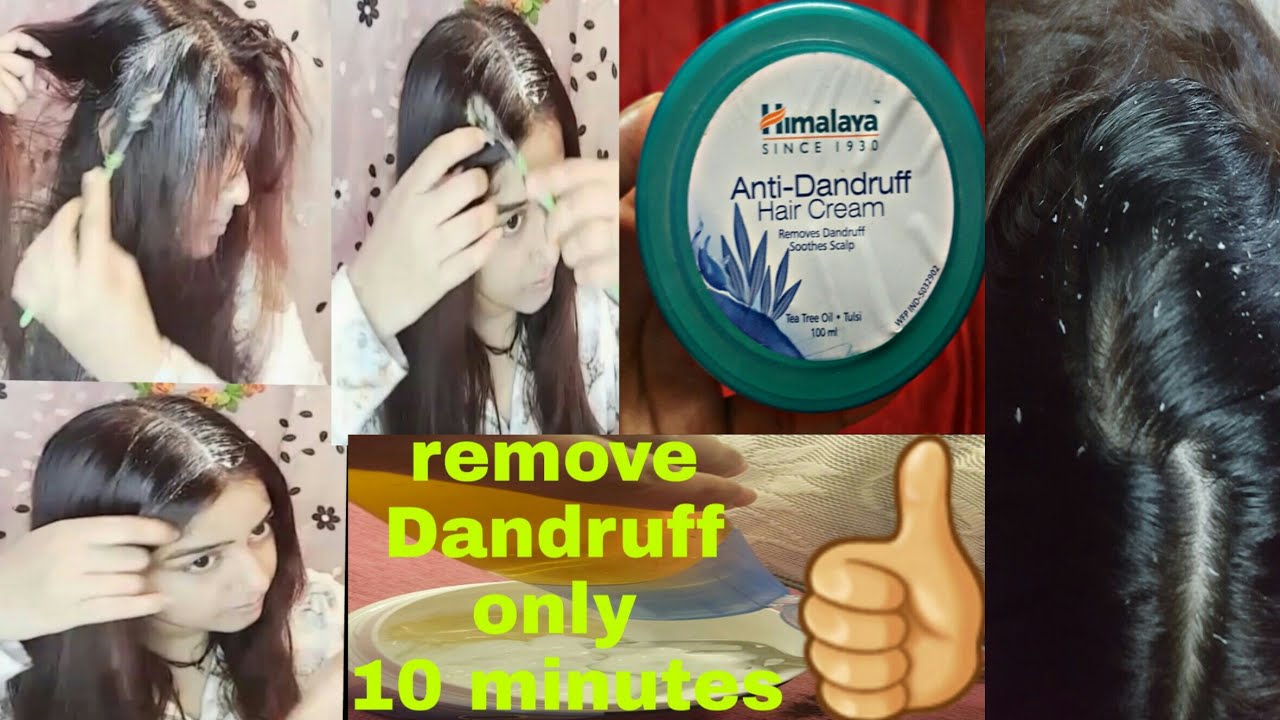 Best Anti Dandruff Hair Cream review and demo Remove Dandruff