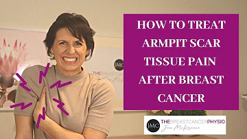 HOW TO TREAT ARMPIT SCAR TISSUE PAIN AFTER BREAST CANCER: Massage and Stretching Techniques