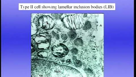 Mechanics of Breathing Part I