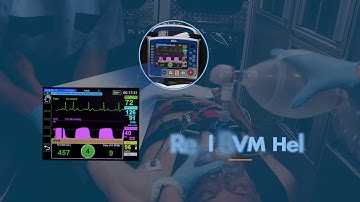 X Series Advanced Sizzle Video - Nederlands