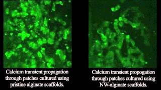 Cardiac patches of gold Wealth