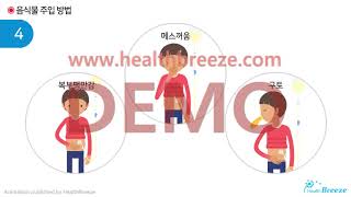[시연용] c0216acko_소아환자의 위루술 안내(3) 음식물 및 약물주입 방법