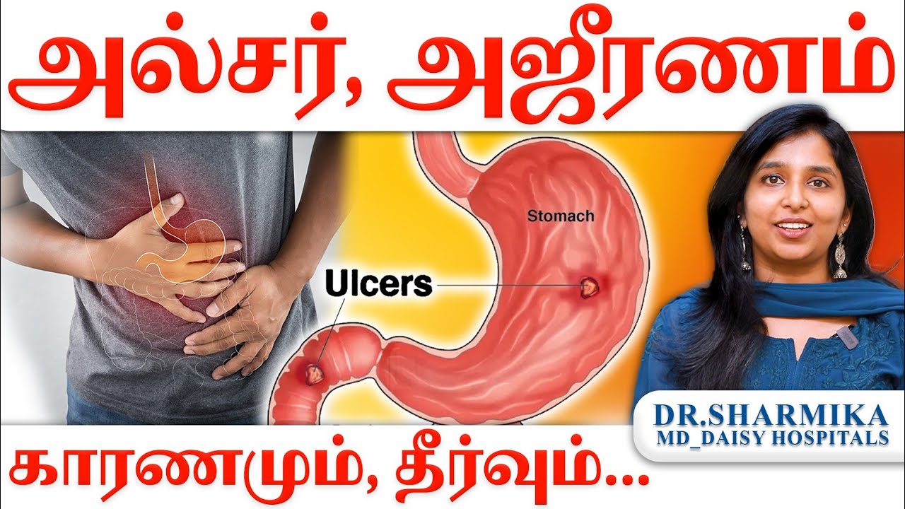 அல்சர், அஜீரணம் - காரணமும், தீர்வும்… | Ulcer, Indigestion - Causes & Solutions #drsharmika #tdaisy 