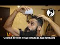 How To Get Thick Hair Naturally - Part 1 | Bearded Chokra