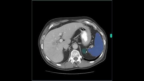 Slice-to-slice image segmentation.