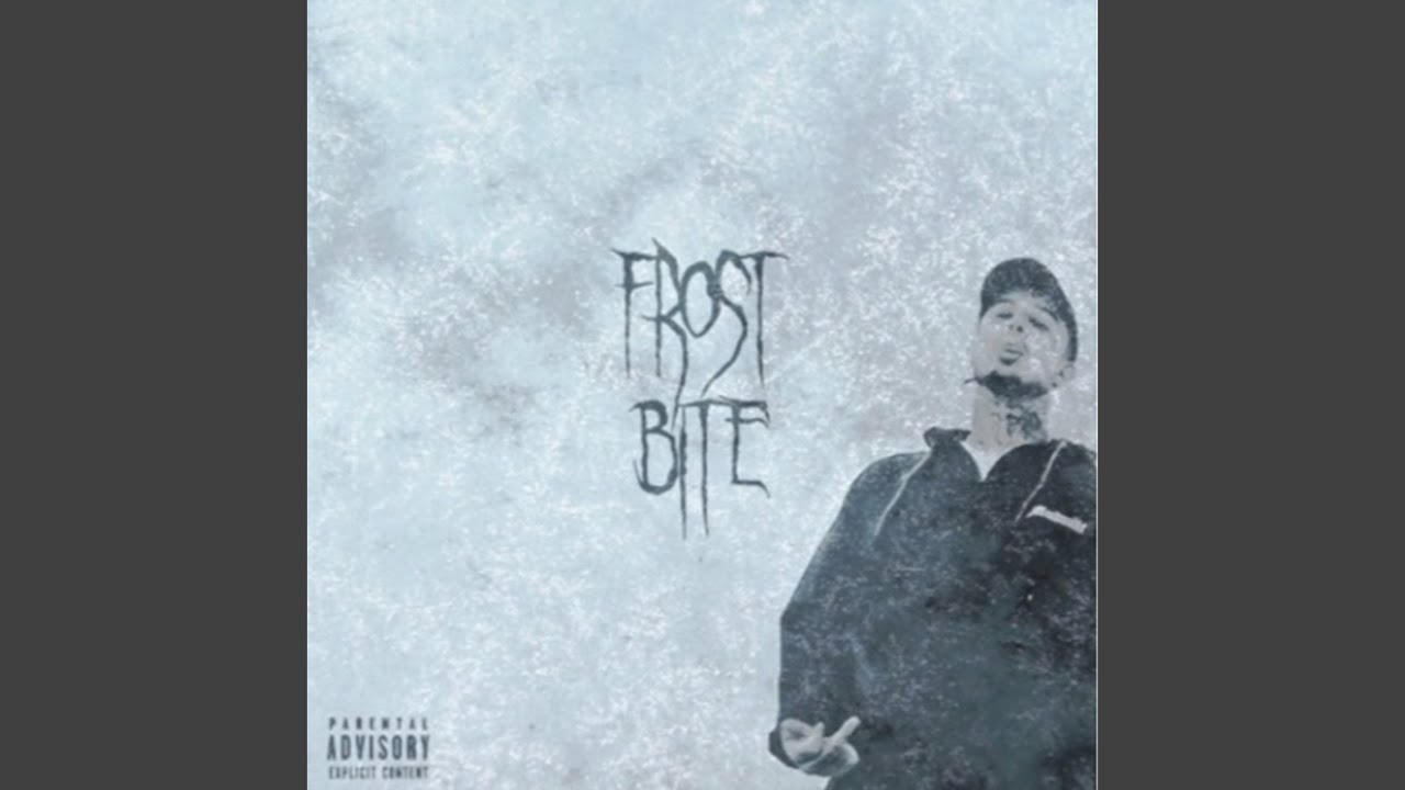 Guarda Frostbite su YouTube Guarda Frostbite su YouTube