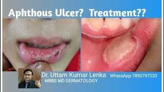 Aphthous ulcer?(repeated ulcers in mouth/Muh ke ander chhala aur ghao kyun hota he/ilaz )