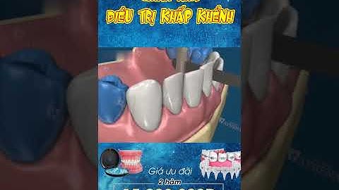 [3D] CHỈNH NHA ĐIỀU TRỊ KHẤP KHỂNH || Nha Khoa Quốc Tế Athena