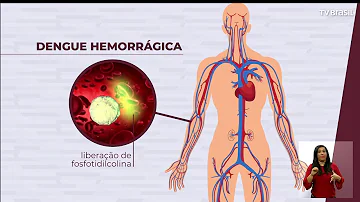 O que a dengue hemorrágica causa?