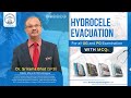 Hydrocele Evacuation