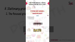 Types of Grids in Radiology