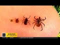 Health Officials Warn Of Tick Borne Disease Babesiosis 
