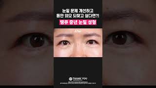눈밑 개선하고 동안 외모 다시 찾고 싶다면?! #눈밑지방재배치  #눈밑지 #눈성형 #성형 #성형외과 #shorts